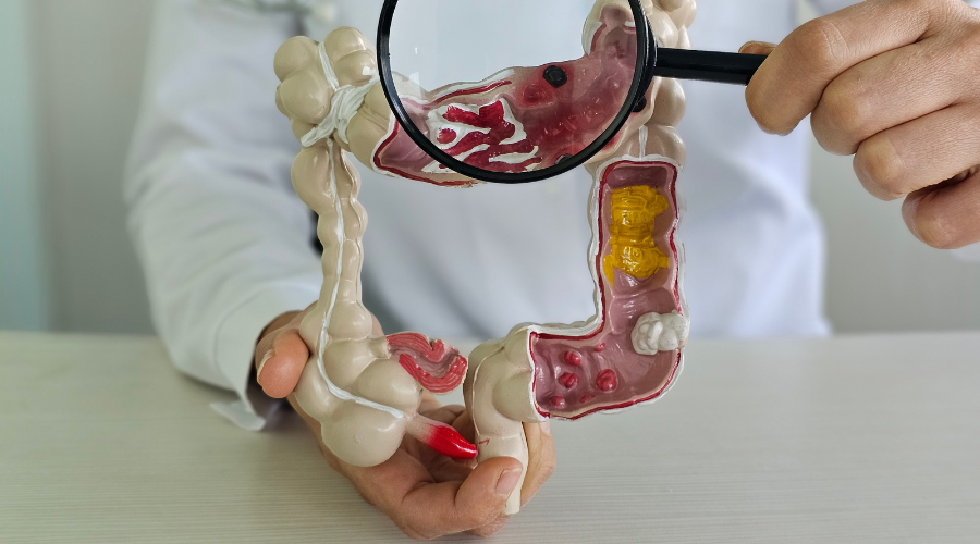 Piles Treatment (Non-Surgical)